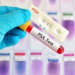 Prostatakrebs: Wie effektiv sind PSA-Tests?