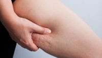 Cellulite-Alarm: Was Pflanzenstoffe bewirken