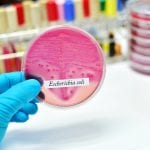 E. coli-Bakterien: Schutz durch Probiotika?