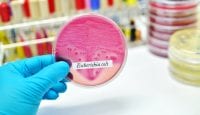 E. coli-Bakterien: Schutz durch Probiotika?