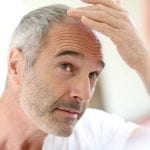 Bestimmtes Medikament verhindert bei Männern Glatze, vielleicht aber auch Sex