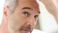 Bestimmtes Medikament verhindert bei Männern Glatze, vielleicht aber auch Sex