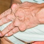 Fingerarthrose? Vielleicht Diabetes schuld!