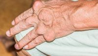 Fingerarthrose? Vielleicht Diabetes schuld!