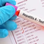 Hepatitis A als Folge von sonnengetrockneten Tomaten