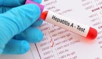 Hepatitis A als Folge von sonnengetrockneten Tomaten