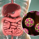 Gefährlicher Norovirus auch auf Kreuzfahrtschiffen
