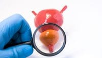 Heilpflanzen bei Impotenz und Prostabeschwerden
