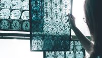 Lichttherapie: Die Antwort auf Alzheimer?