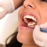 Ein Pflanzenstoff könnte die Geheimwaffe gegen Zahnfleischerkrankungen sein