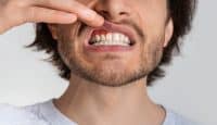 Kann Fasten Zahnfleischerkrankungen bekämpfen? Forscher entdecken einen überraschenden Zusammenhang