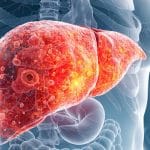 Darmhormone könnten der Schlüssel zur Bekämpfung der Fettlebererkrankung sein