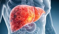 Darmhormone könnten der Schlüssel zur Bekämpfung der Fettlebererkrankung sein